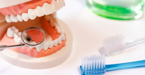 虫歯の模型と歯ブラシ
