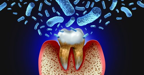 歯周病が様々な病気を引き起こしているイメージ